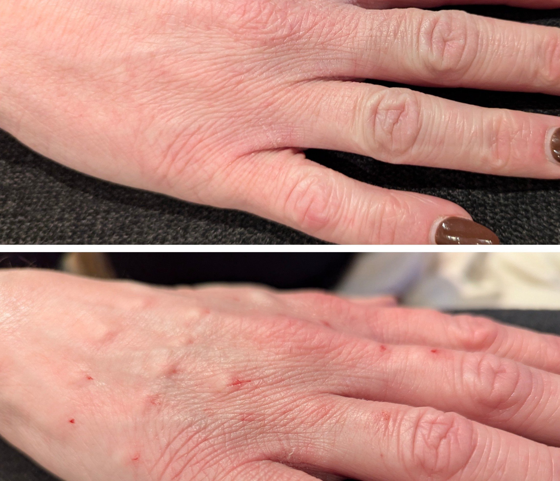 Close-up of a person's hand with light skin, showing the fingers and part of the palm on a dark surface.