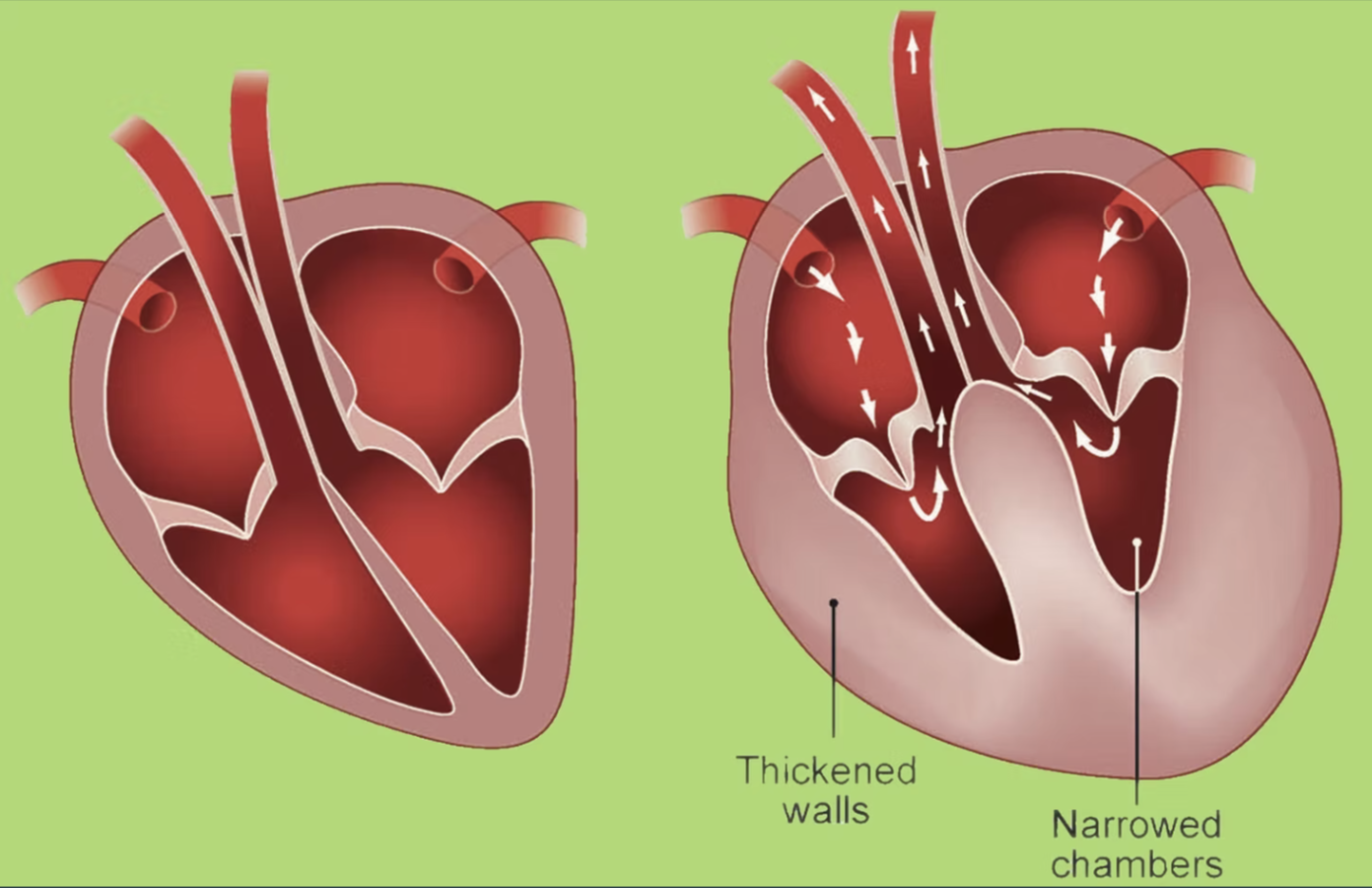 Understanding HCM in Sphynx Cats: Promoting Healthy Breeding Practices.