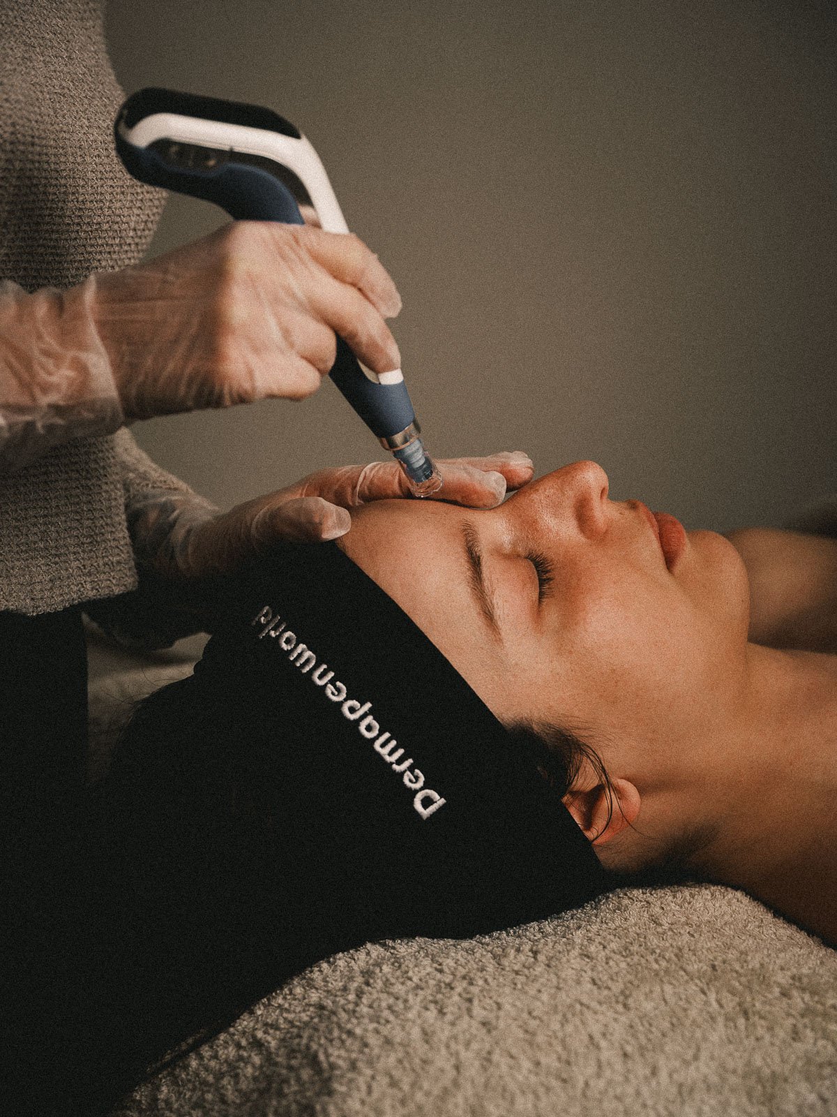 Ayune-Web-Dermapen-@-2026-Paolo-Galgani-02.jpg