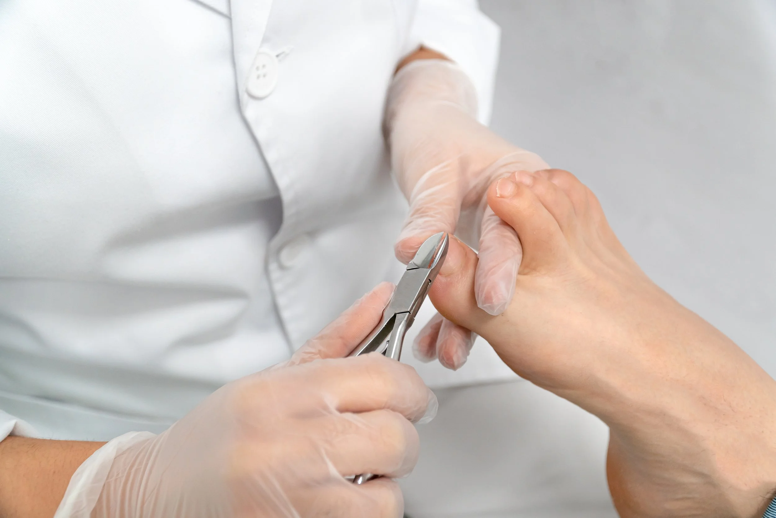 A healthcare professional with gloves trimming a patient's toenails with nail scissors. Lenzie Podiatry Book now Podiatry Chiropody