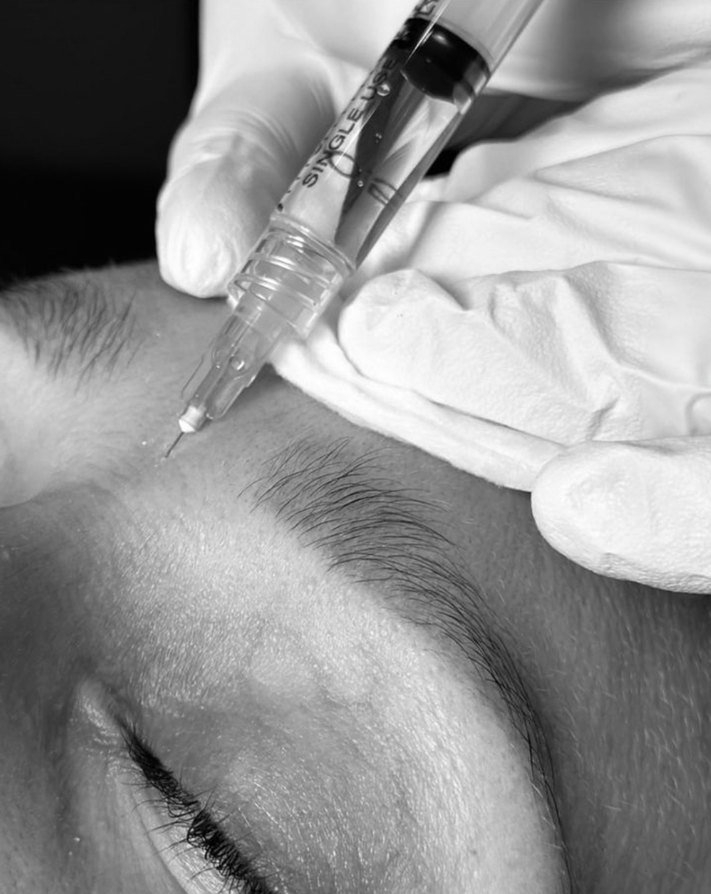 Why Your Botox Isn’t Lasting 