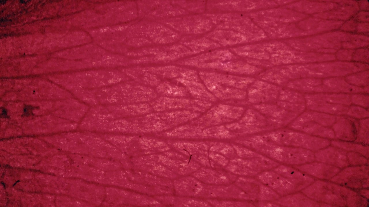 A Holistic, Clinical Nutritionists Guide to Eczema