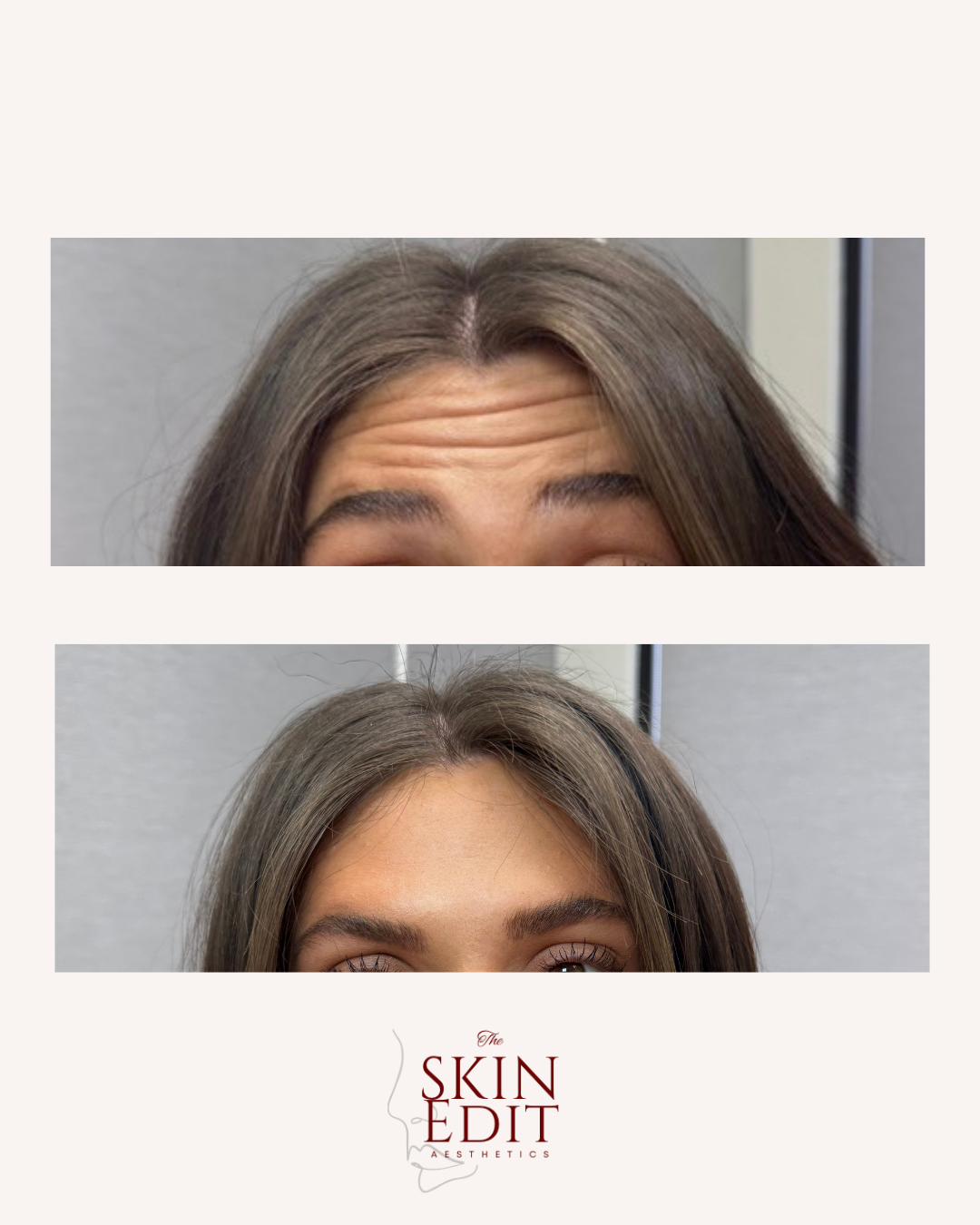 The Skin Edit Aesthetics | Before + After (7).PNG