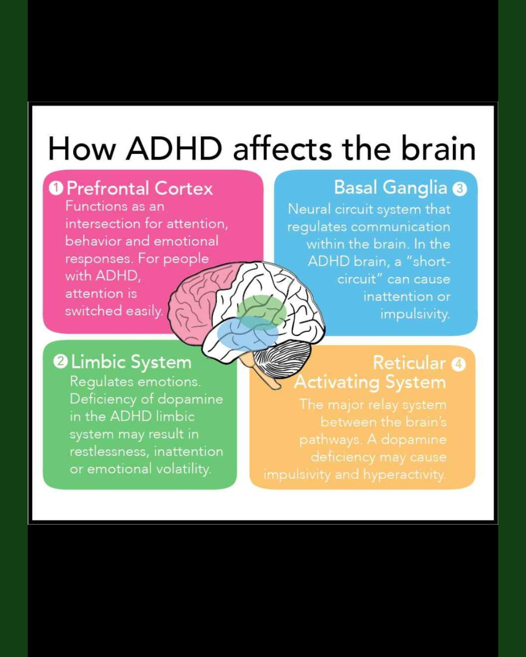 Diagram of how ADHD affects the brain, showing four key regions: prefrontal cortex, basal ganglia, limbic system, and reticular activating system, with descriptions of their functions related to ADHD.