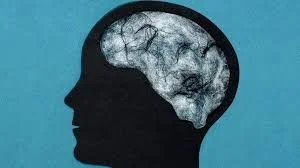 Brain Fog: What It Is, Why It Happens, and What Actually Improves It