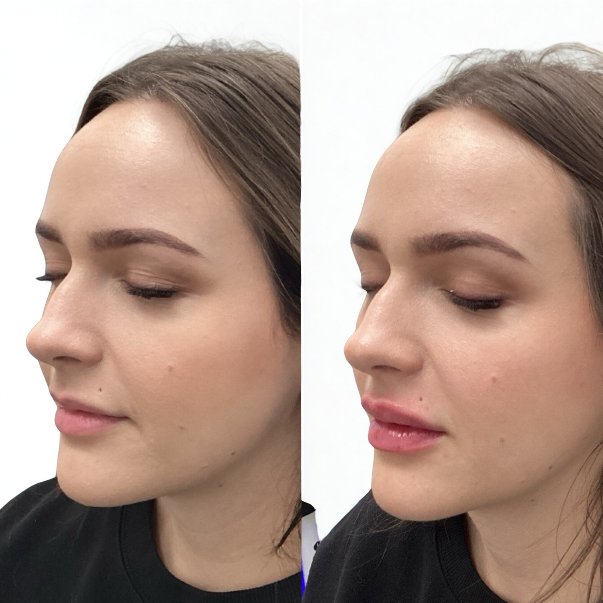 NURSE INJECTOR ERICA.PNG