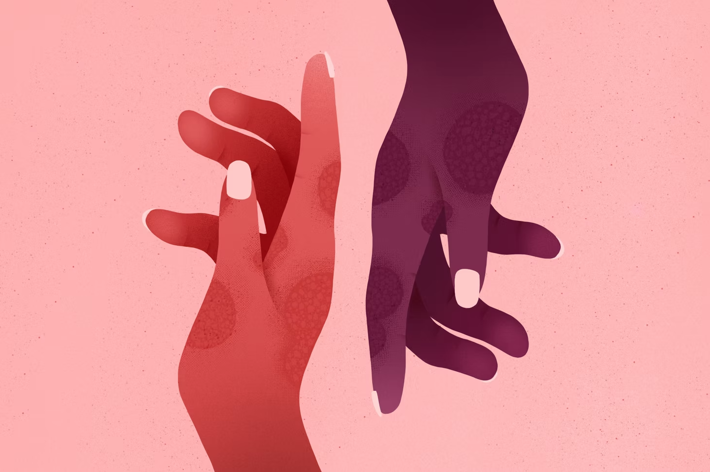 The New York Times  What exactly is eczema? 