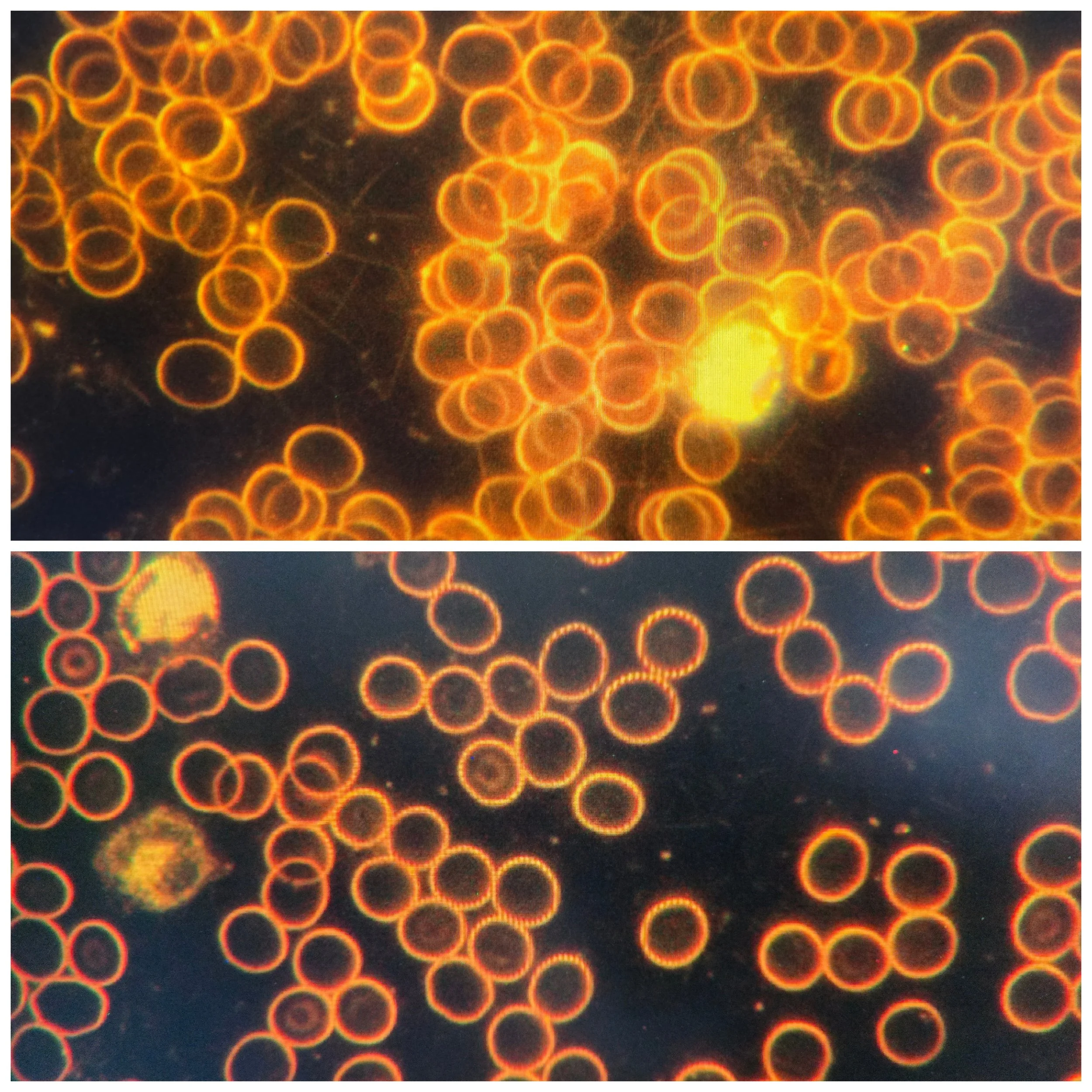 Microscopic view of red blood cells with glowing orange outlines, showing different cell arrangements and shapes.