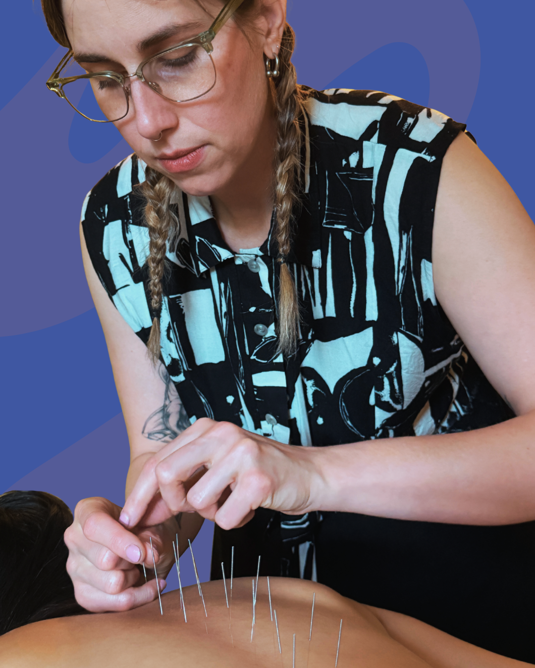 Acupuncture practitioner performing acupuncture treatment for back pain and insomnia