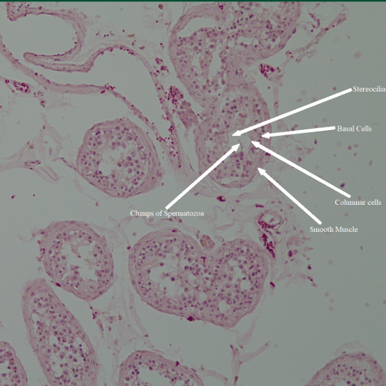 Histology of the Left Testis