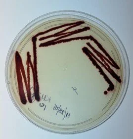 Unknown Lab Project Clinical Microbiology