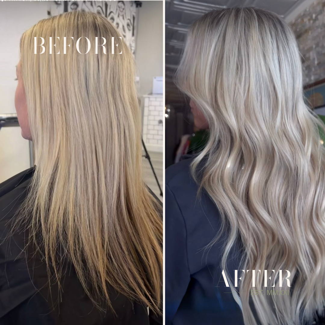 Volume & Fullness.
 Subtle Enhancements That Make a Big Difference.
