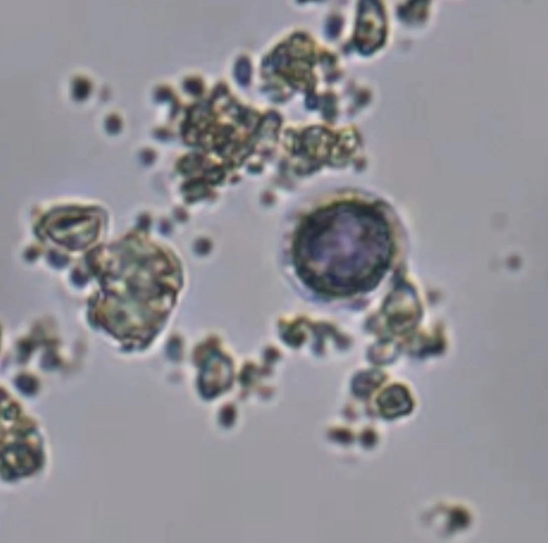 Microscopic view of cells or microorganisms, appearing as round and irregular shapes with internal structures.