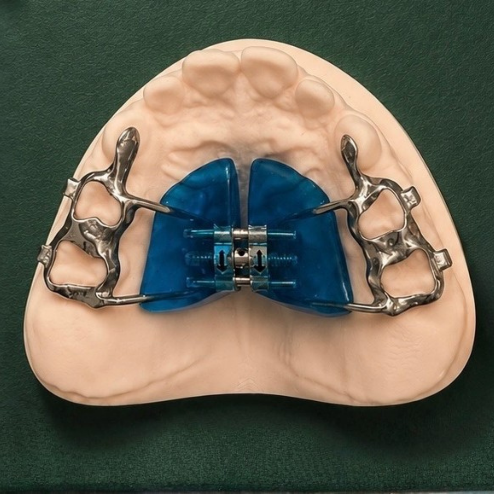 Maxillary Expansion Mandibular Uprighting, Honeybee Pediatrics.