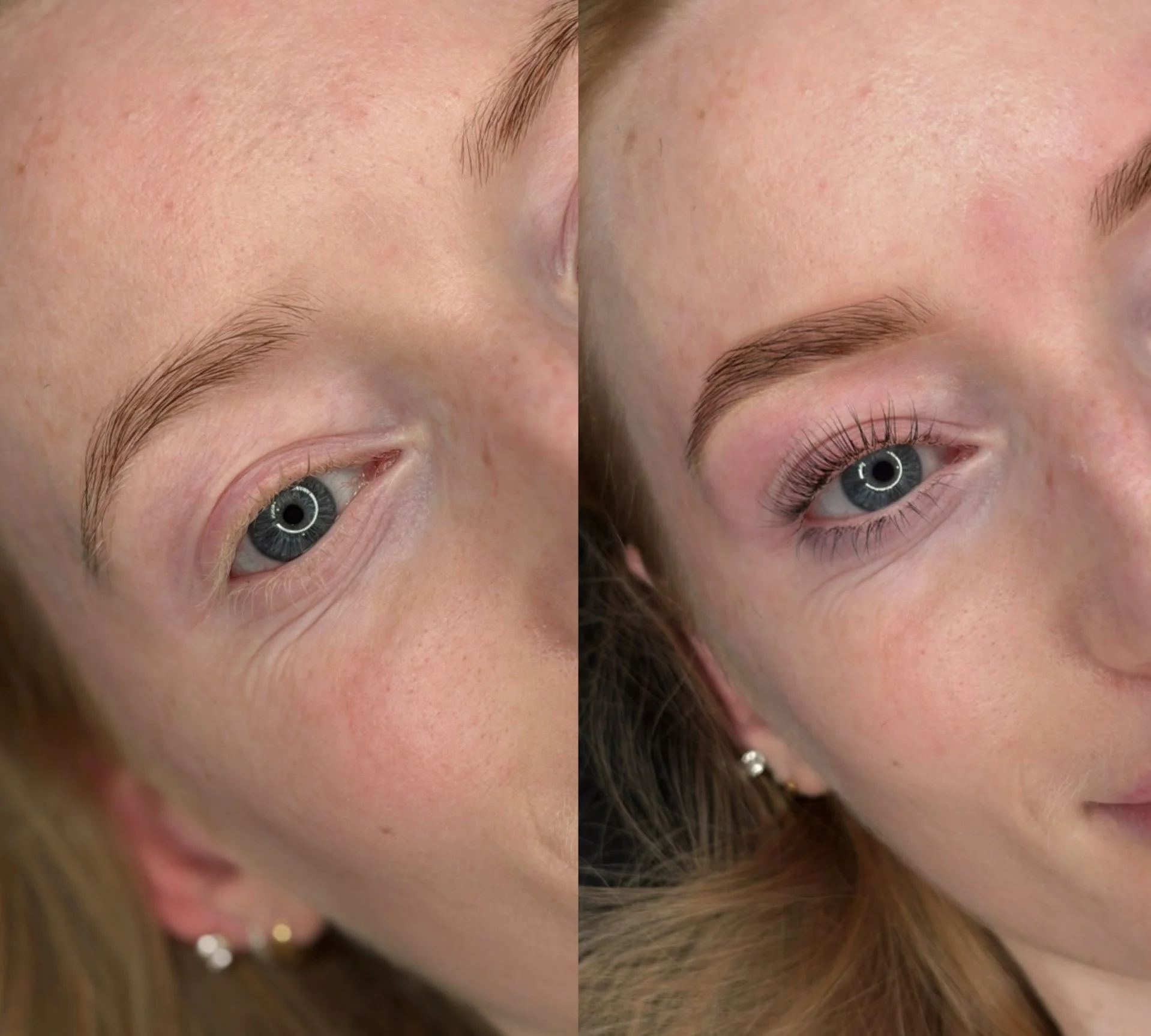 Close-up of a woman's face showing a comparison of her skin before and after skincare treatment, focusing on her forehead and eye area.