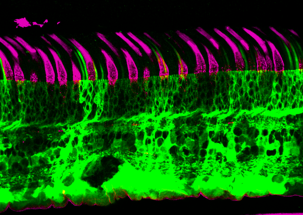 Fluorescent microscopy image of a retinal cross-section transduced by AAVs expressing GFP.