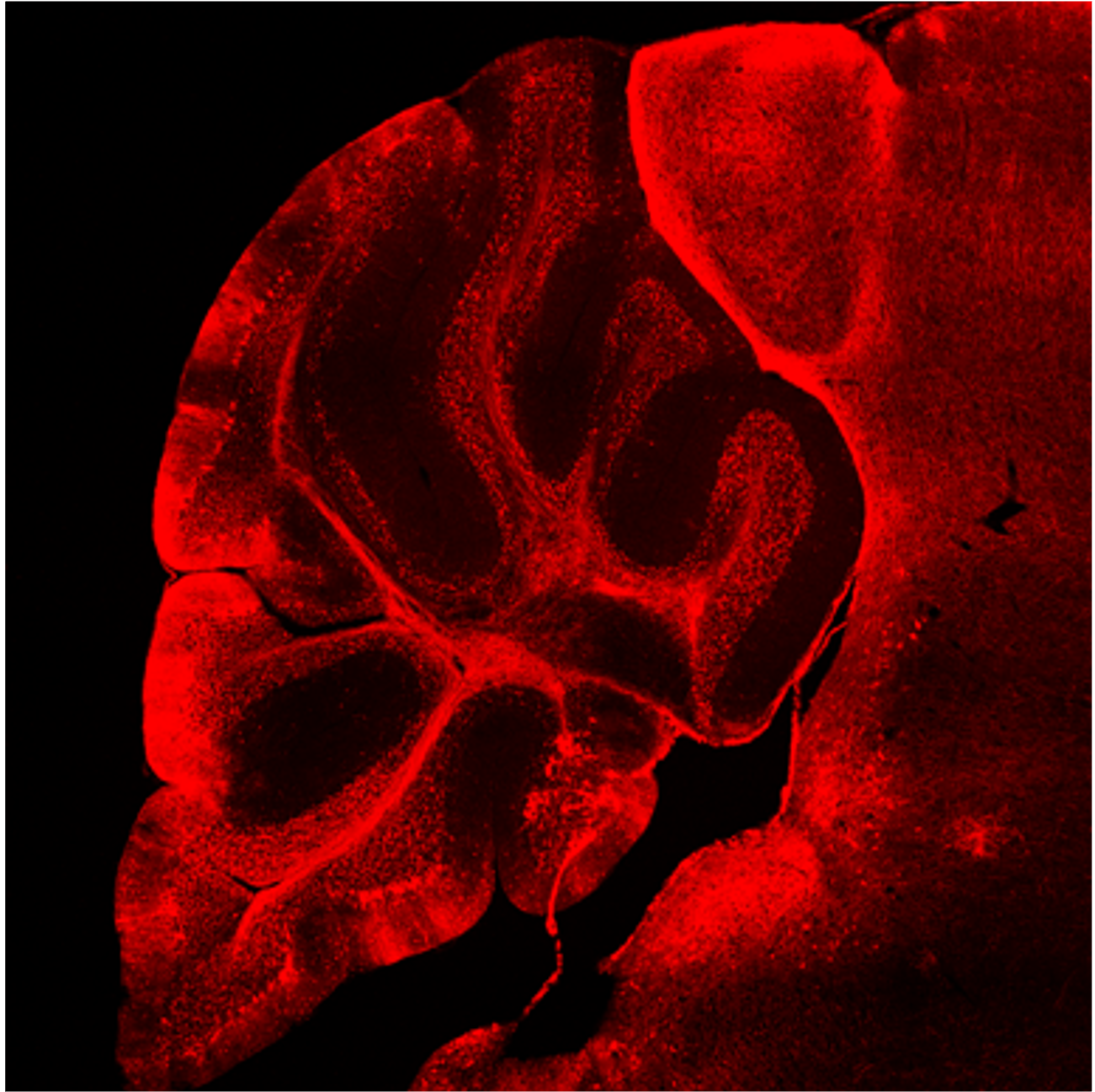 Fluorescent microscopy image of a brain cross-section transduced by AAVs expressing RFP.