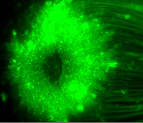 Fluorescent microscopy image of a flatmount of a retina transduced by AAVs expressing GFP.
