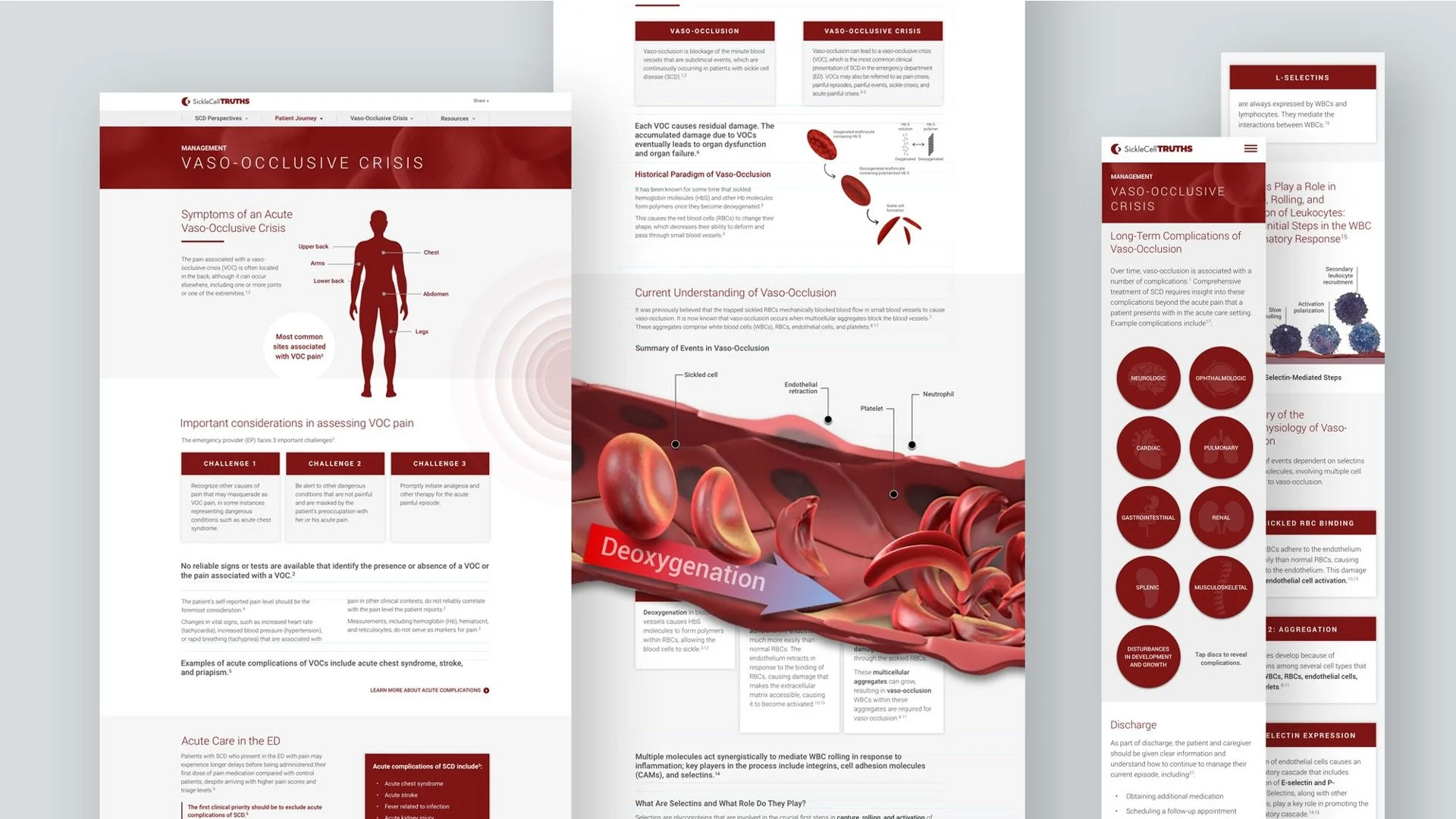 A digital infographic about Vaso-occlusive crisis, showing human body diagram, blood cell images, and information on symptoms, diagnosis, and complications.