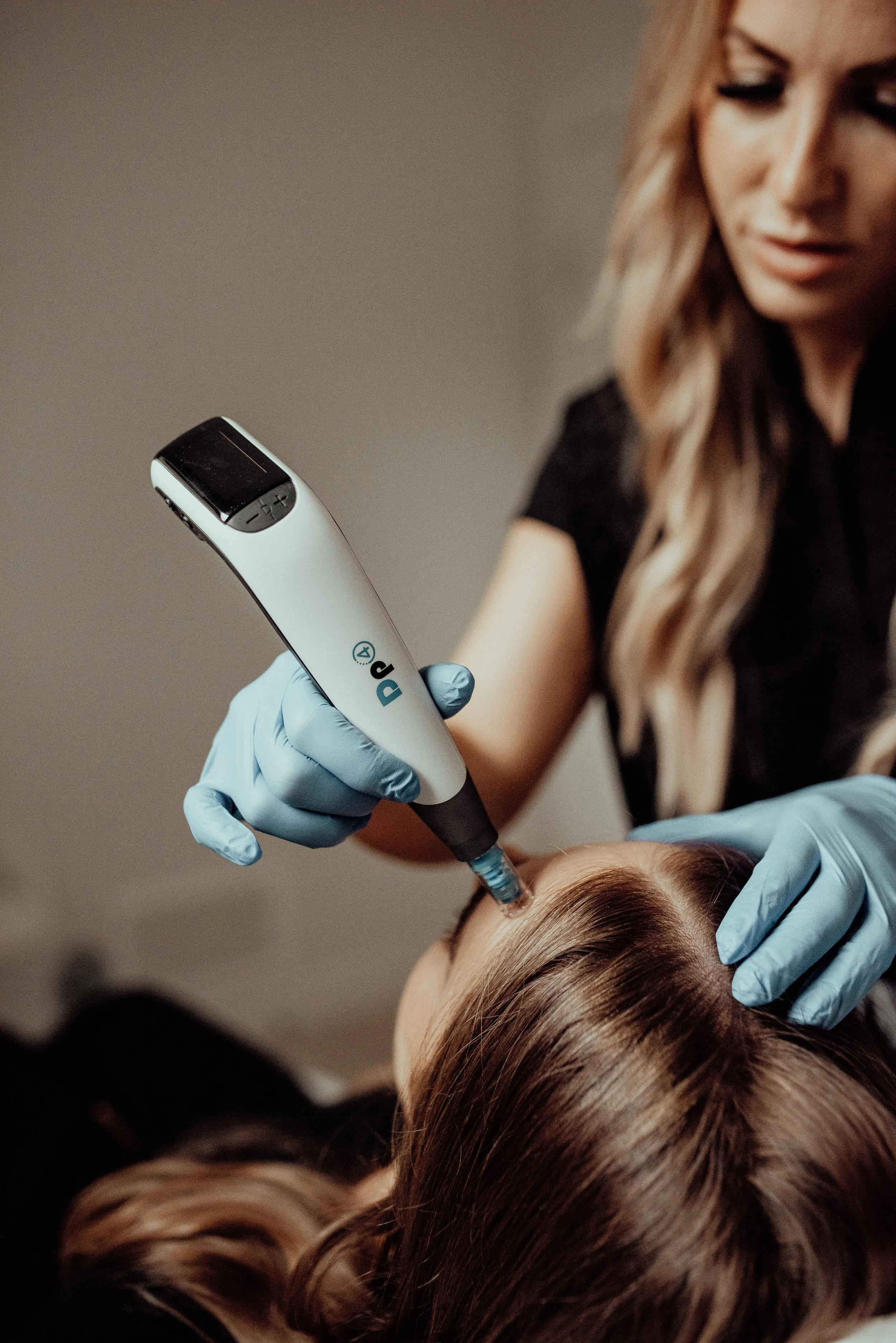 Professional microneedling treatment performed at Juvenescence Wellness to stimulate collagen and rejuvenate the skin.