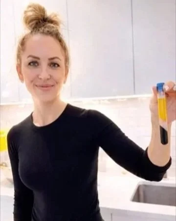 PRP Therapy: A Regenerative Approach to Skin, Hair, and Tissue Health