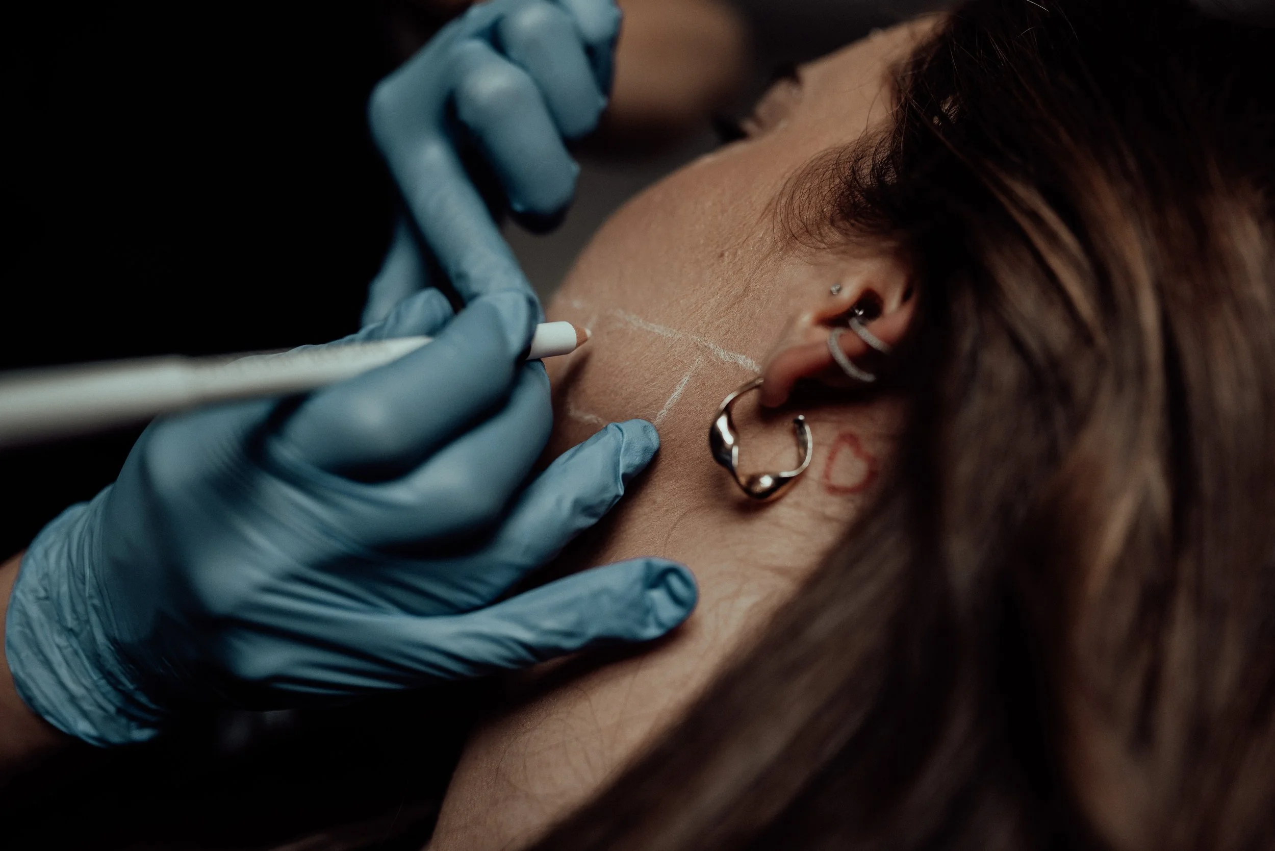 Advanced chemical peel and microneedling treatments for brighter, smoother skin at a Vancouver Island aesthetics clinic.