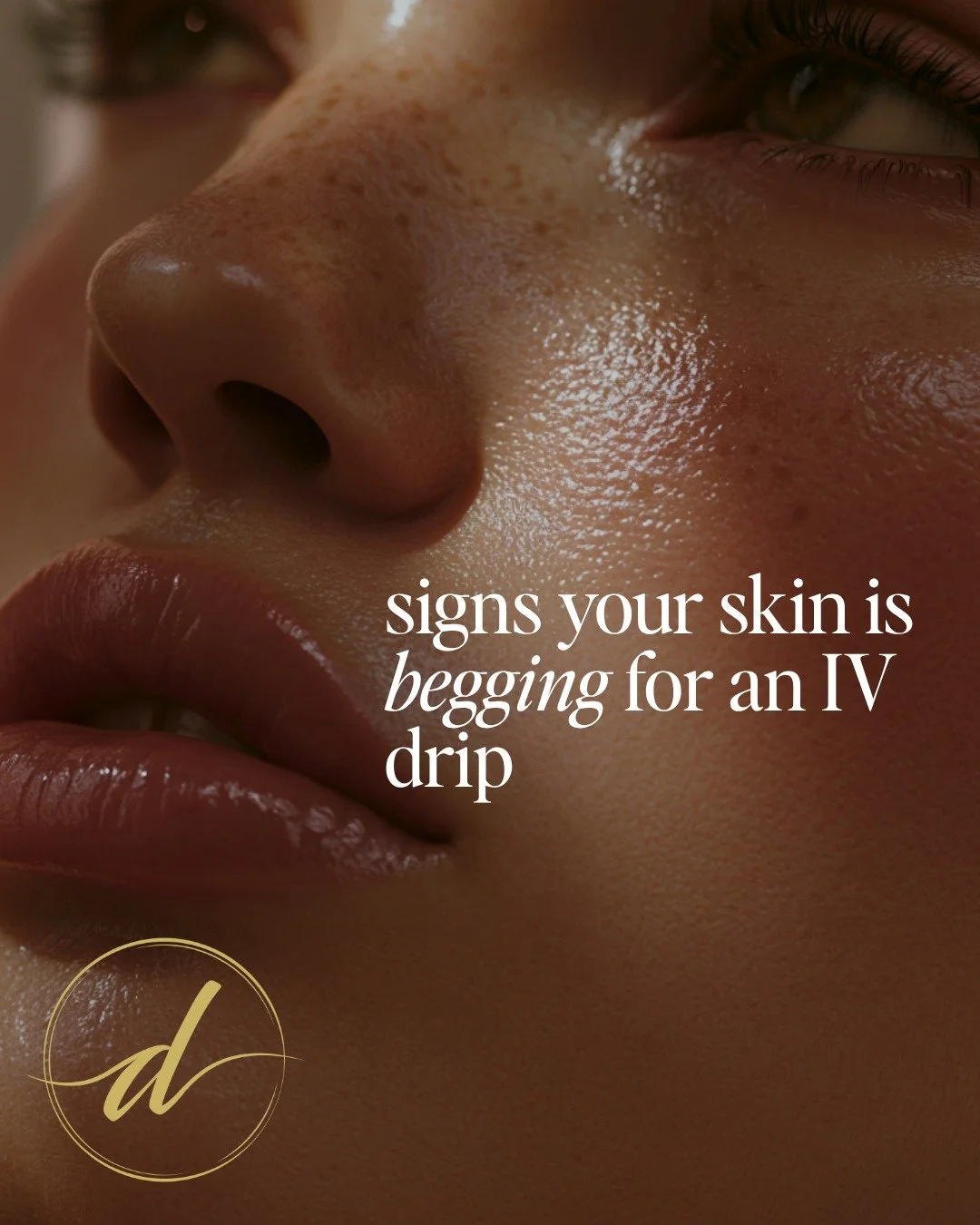When your skin needs a rescue, it's a sign to indulge in our hydration-focused IV therapy. Let us bring back that radiant glow right to your doorstep. 
#dripvip #mobileiv #longisland #skincare