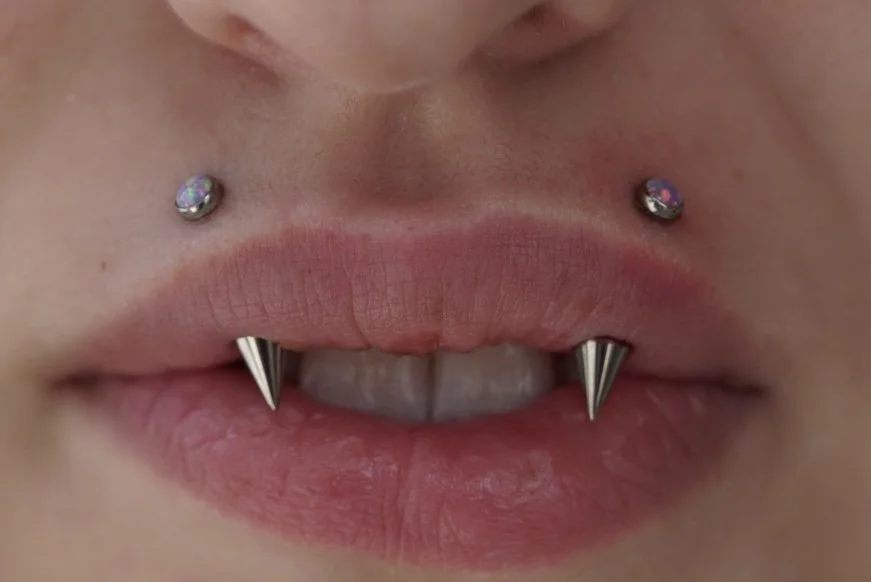 Downsized angel fangs with implant grade titanium
