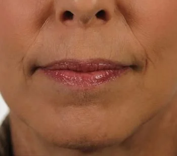 Close-up of a person's lower face showing lips and chin.