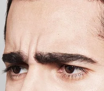 Close-up of a man's forehead and eyes with furrowed brows.