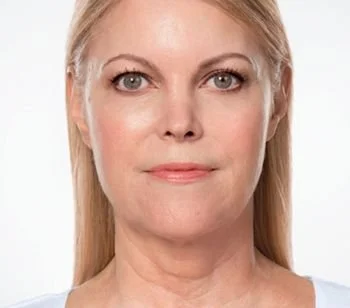 A woman with blonde hair and fair skin looking directly at the camera against a white background.