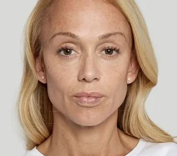 Close-up portrait of a woman with blonde hair and light skin, facing forward.