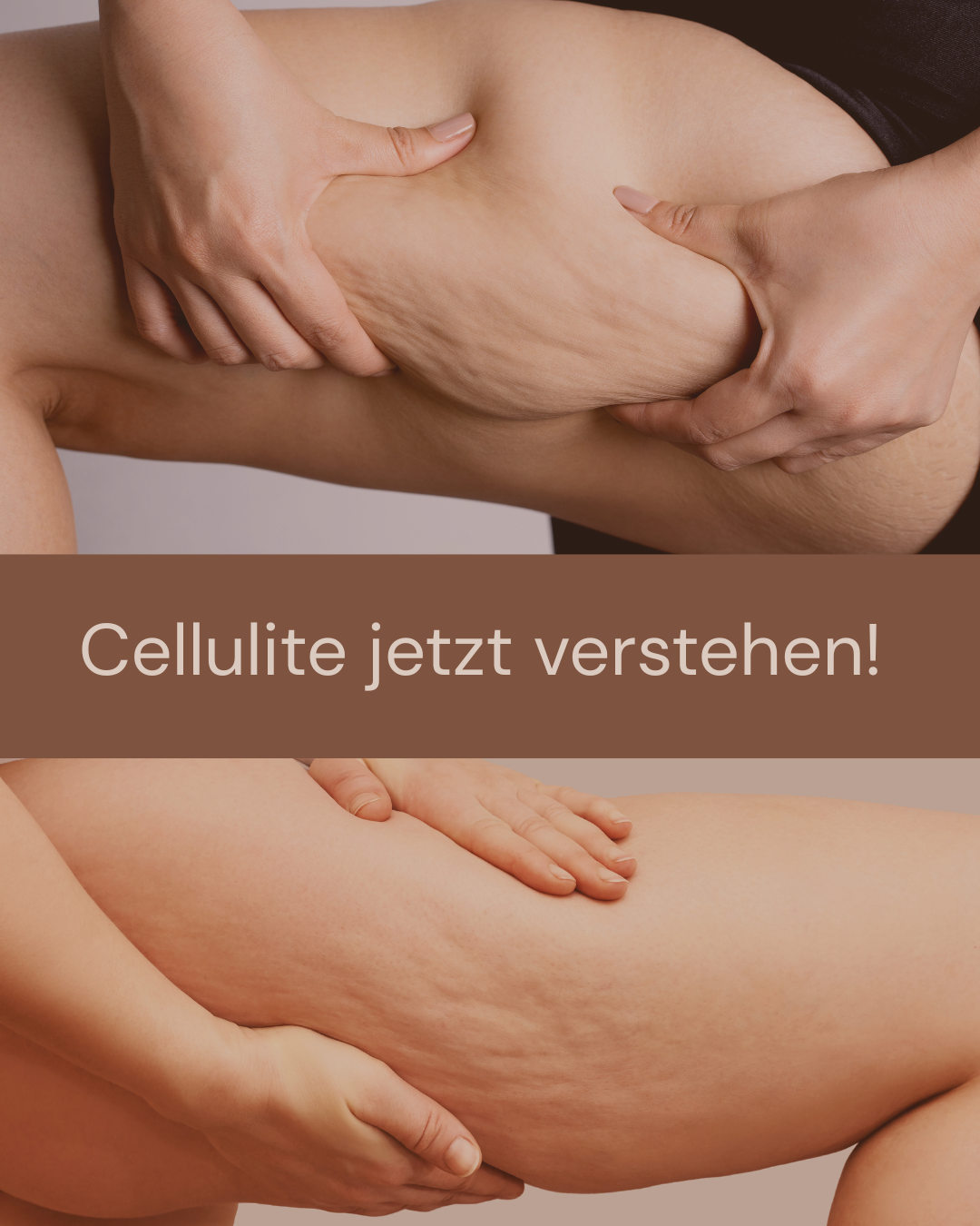 Bindegewebe &amp; Cellulite: was steckt dahinter und wie kann BellaBambi unterstützen?