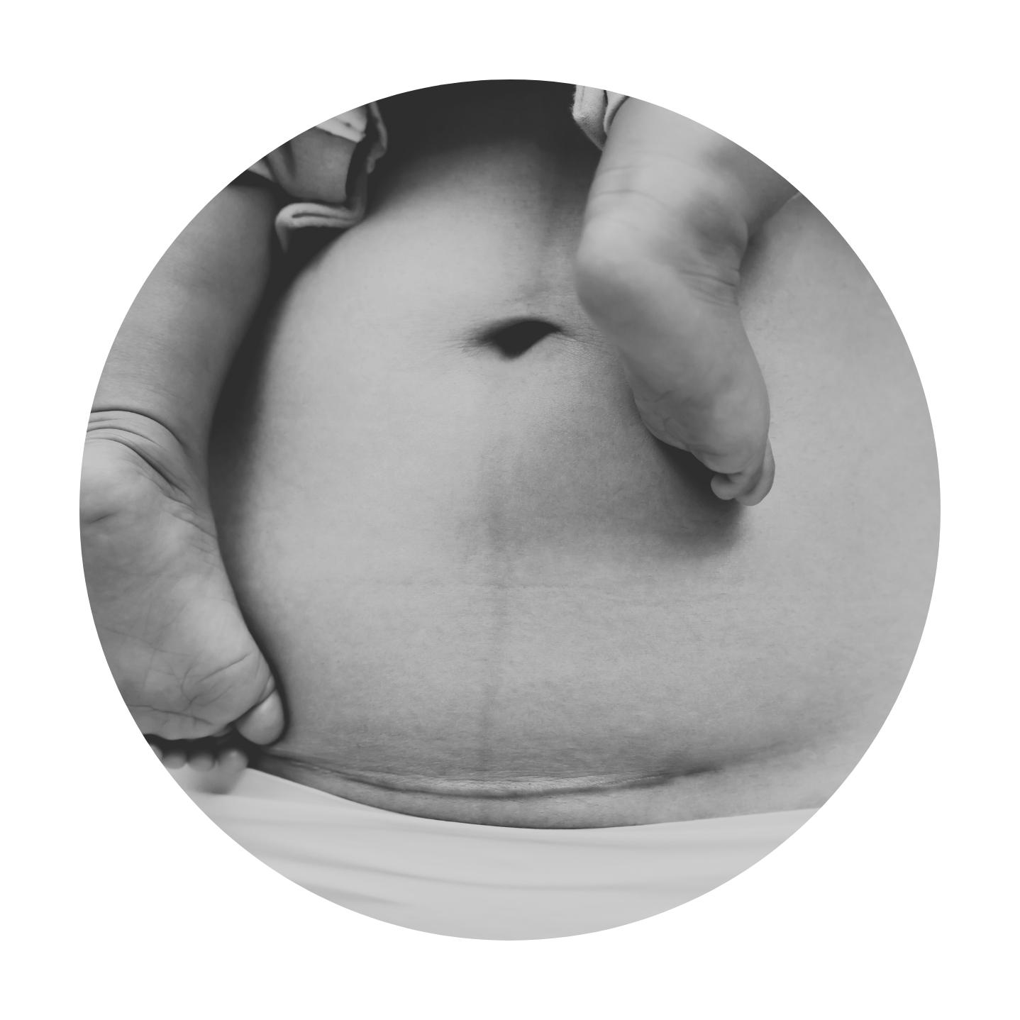 Close-up of a person's belly button with c-section scar holding baby