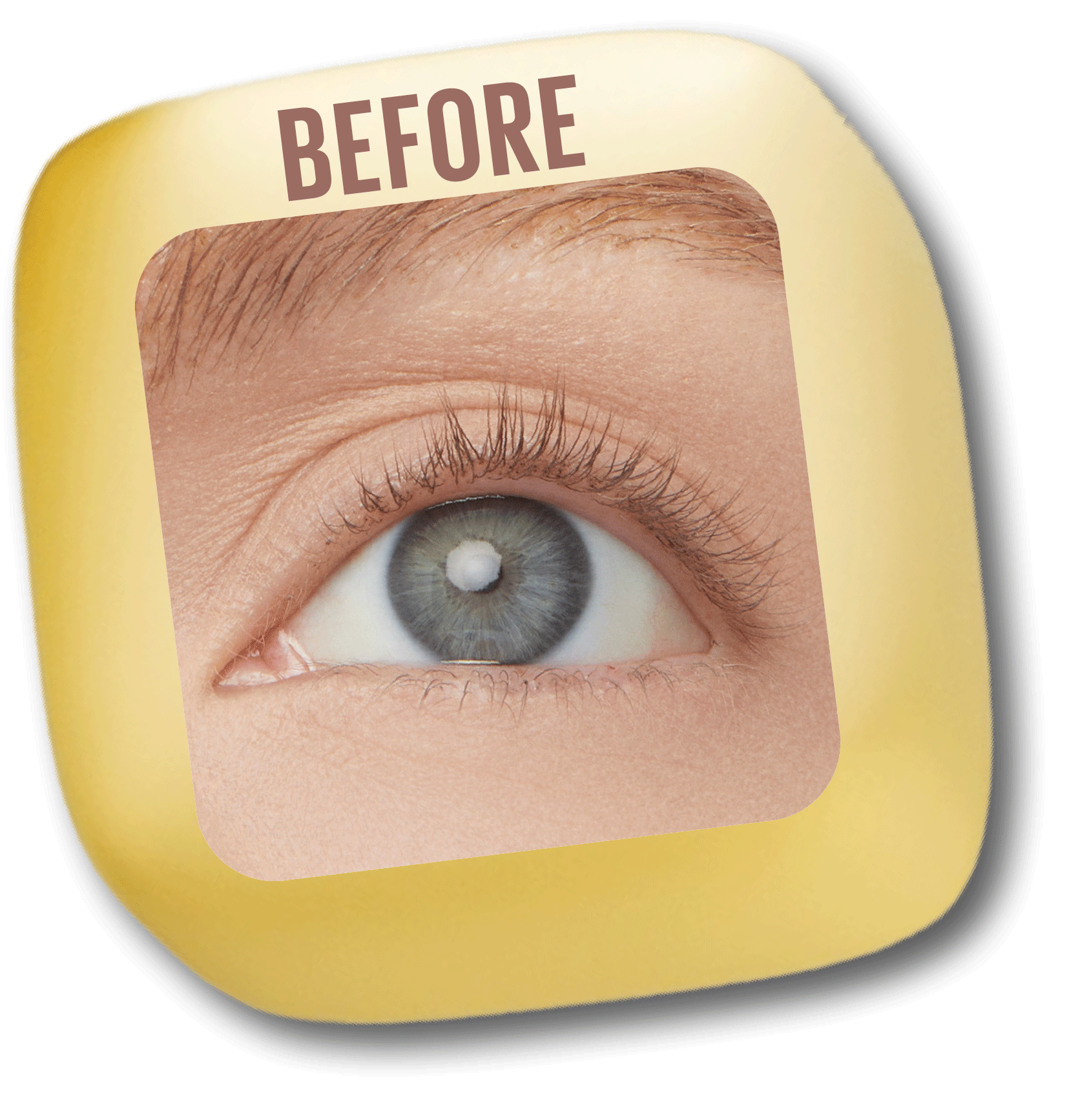 Close-up of a person's eye with the word 'BEFORE' written above in bold brown font, part of a yellow container.