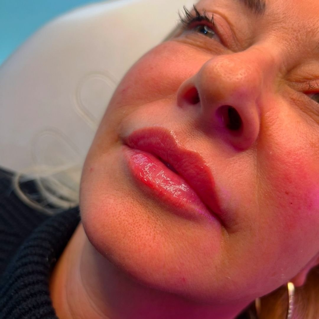 Close-up of a smiling woman with lipstick and earrings, lying on a hospital bed.