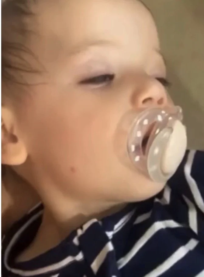 Lethargy or collapse (Severe)
Sudden drowsiness, floppiness, paleness or reduced responsiveness.