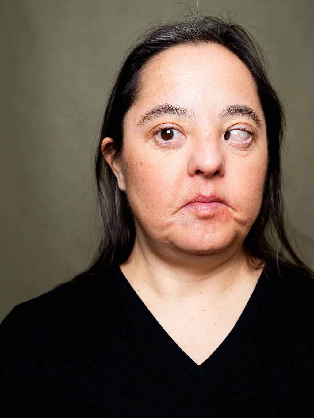 Close-up of a mixed race woman with Downs Syndrome, long dark hair, wearing a black top, with neutral facial expression against a plain background.