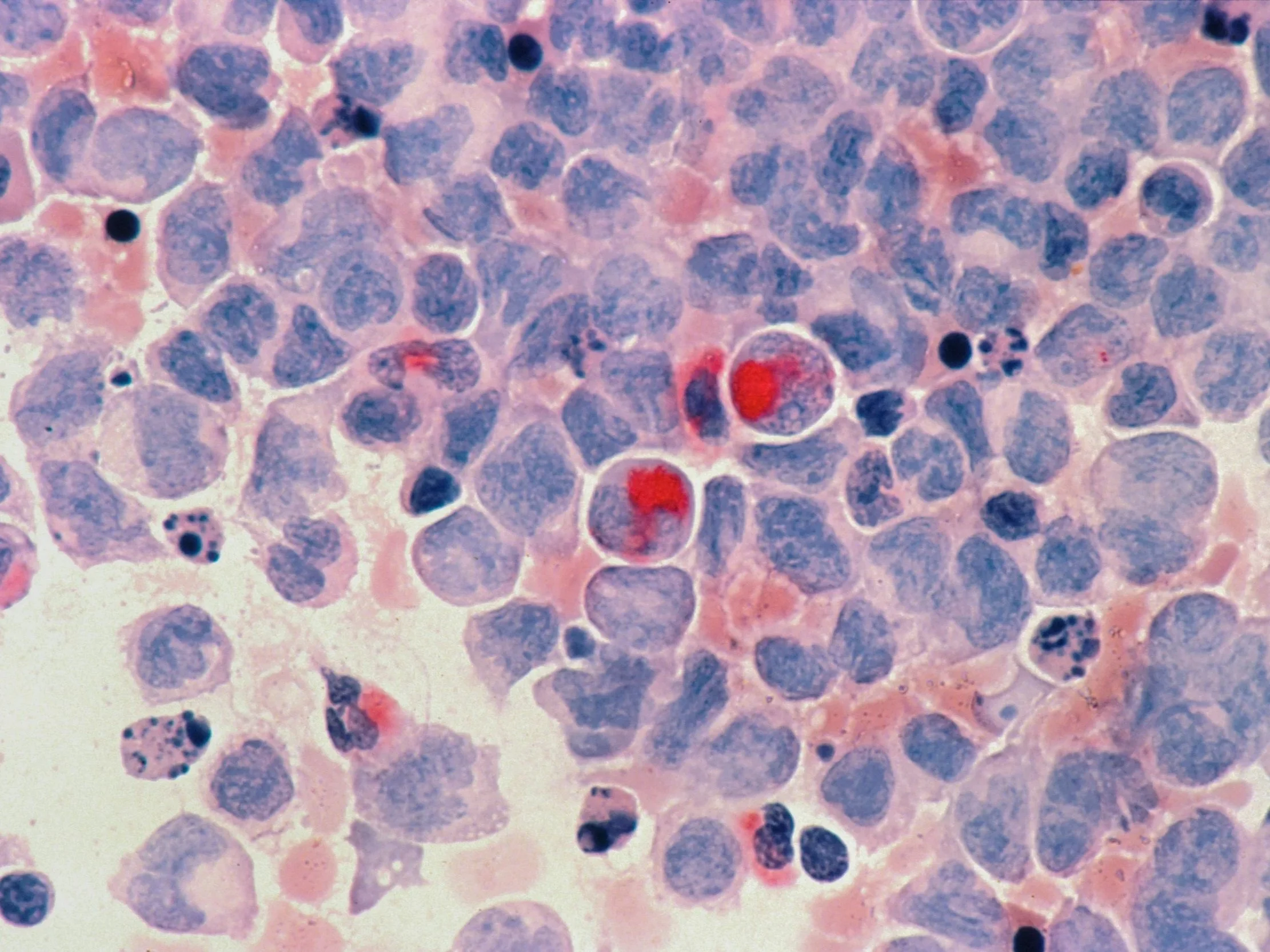 Microscopische afbeelding van cellen, mogelijk bloedcellen, met enkele rode en zwarte insluitsels.