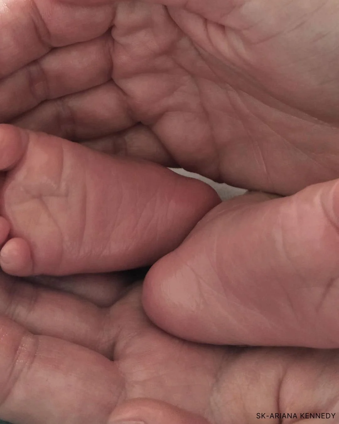 Close-up of multiple hands, showing texture and wrinkles of the skin