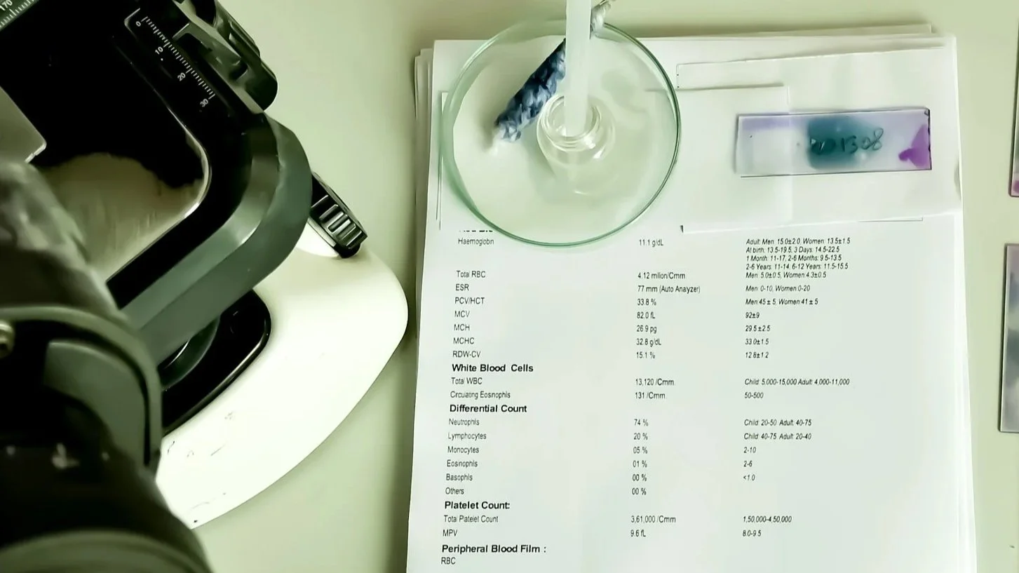View of a blood test report on a white sheet of paper with lab results, a glass slide with a sample, and laboratory equipment including a microscope and a pipette on a white table.