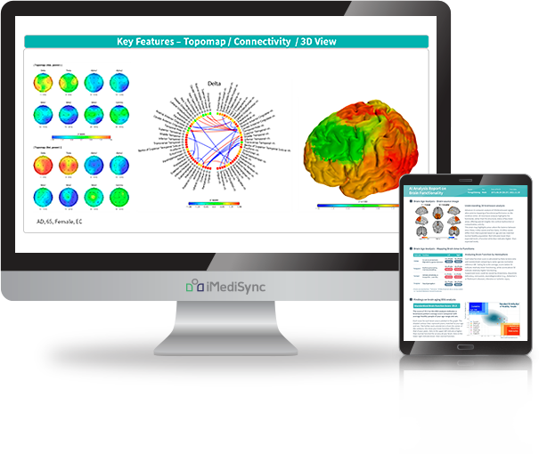 Computer monitor and tablet displaying brain imaging data, including topographical maps, connectivity graphs, and 3D brain models, related to brain analysis.