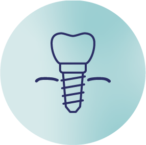Drawing of a dental implant screw with a tooth on top, on a light blue background.