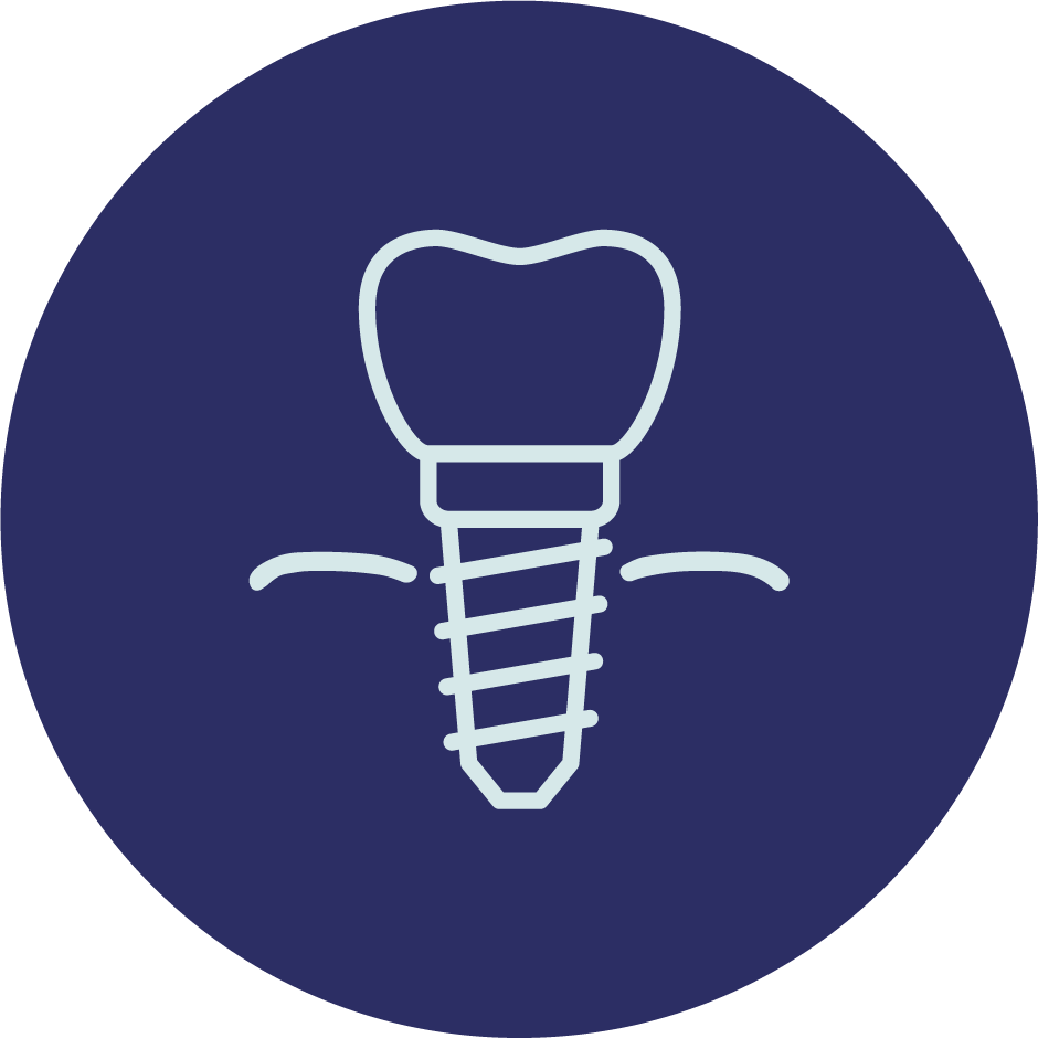 Dental implants