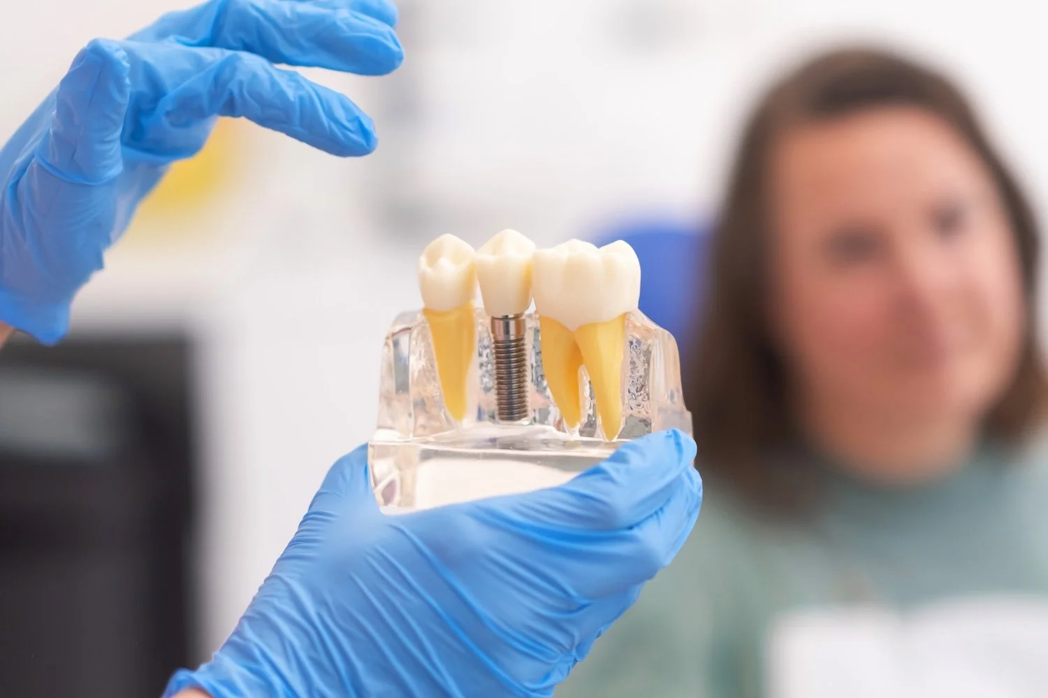 Surgeon holding up a model of dental implants