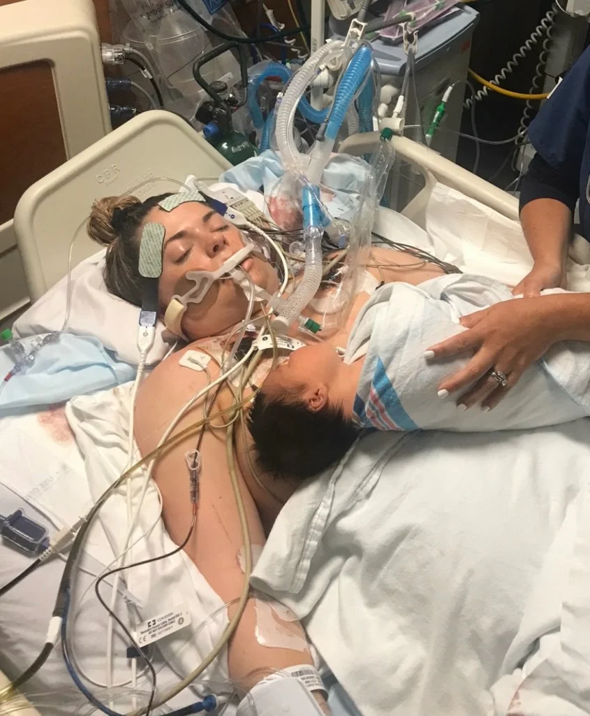 A woman in a hospital bed connected to ventilator and medical equipment, with a young child laying on her chest, in a hospital room.