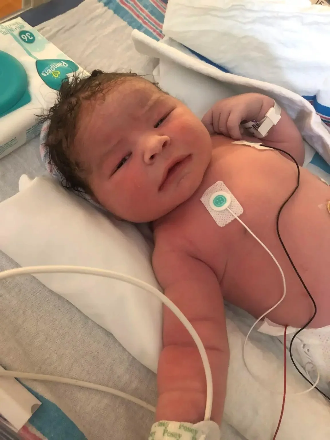 A newborn baby lying in a hospital bed with medical wires attached, holding a finger, surrounded by medical supplies and bedding.