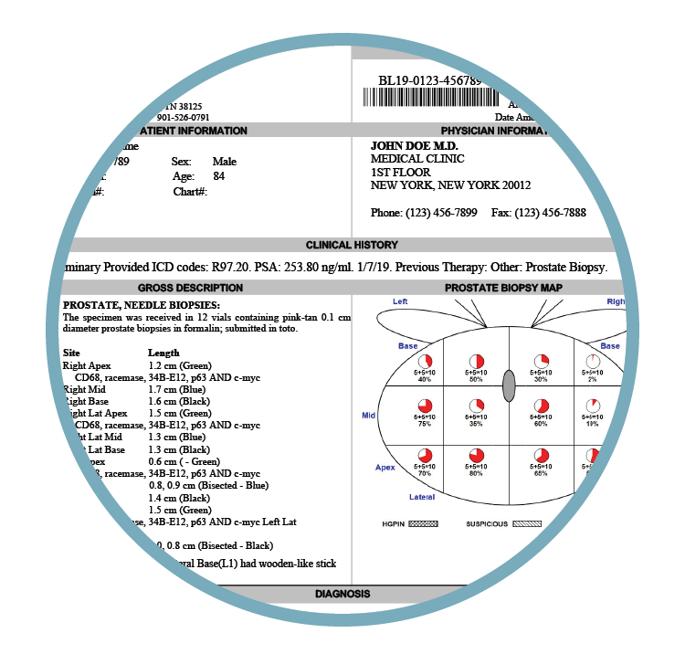 Medical report showing patient information, clinical history, and prostate biopsy map.