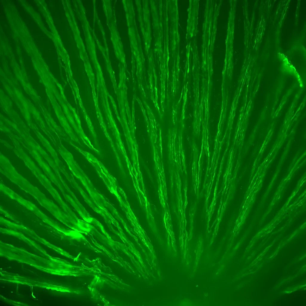 Neuronal axons see in retina wholemount