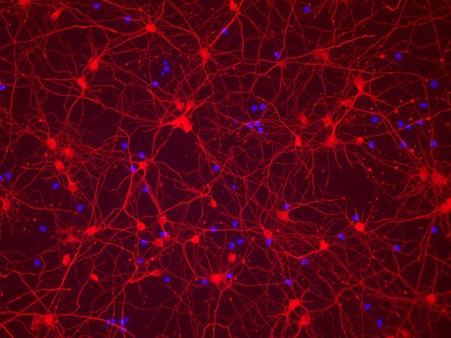Neurodegenerative disease are studied with cultured neurons